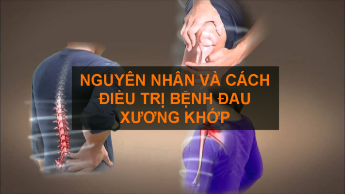 đau xương khớp