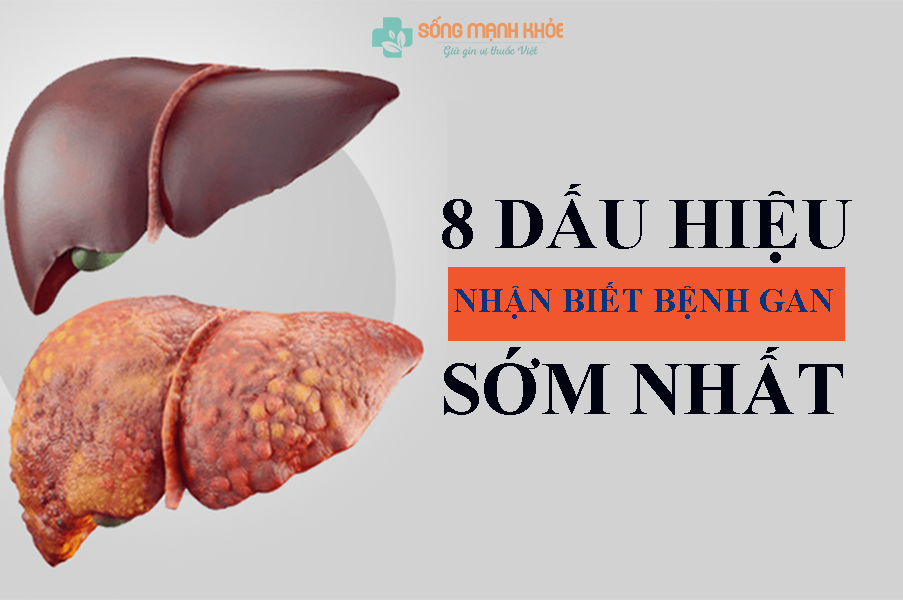 Dấu hiệu nhận biết bệnh gan
