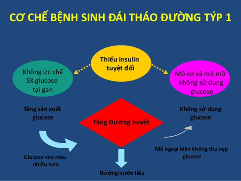 Nguyên nhân gây tiểu đường type 1