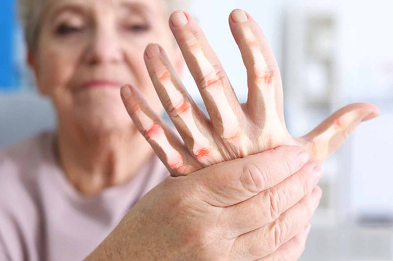 những ai dễ bị bệnh đau xương khớp và dấu hiệu